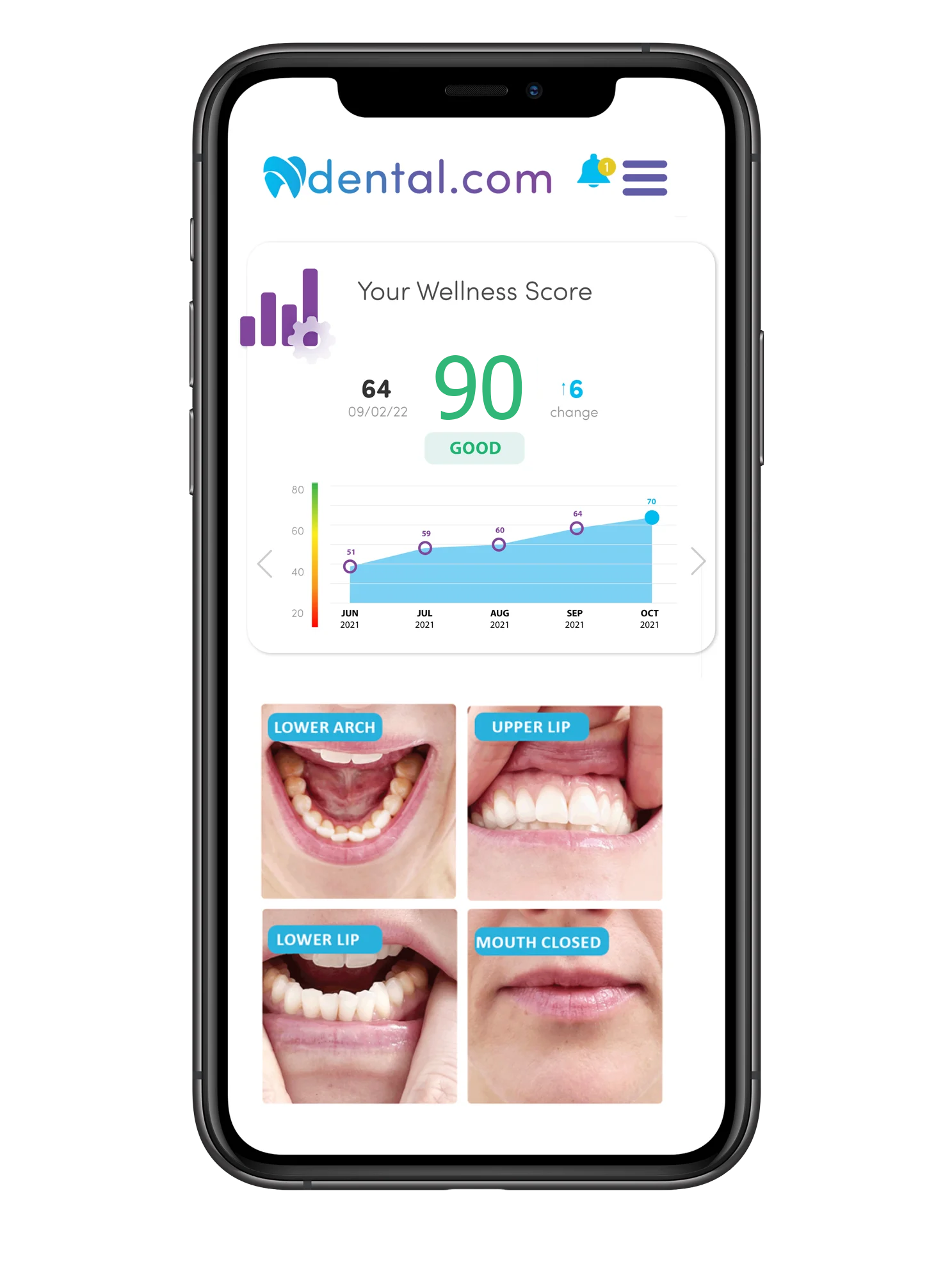 MetLife Online Dental Care Teledentistry