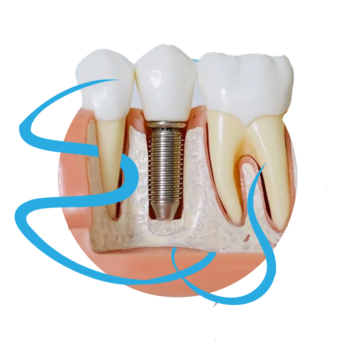 EasterbrookWebsiteImplant